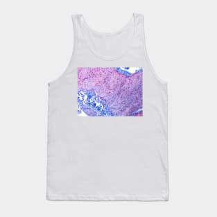 Peripheral nerve, light micrograph (C022/7315) Tank Top